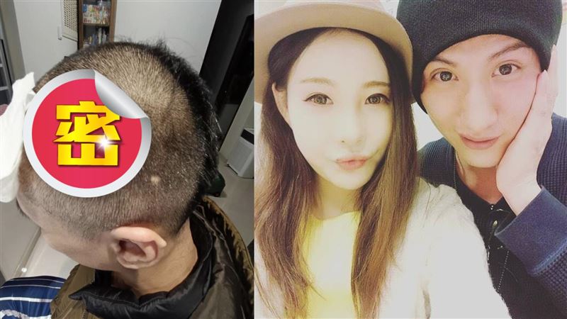 「世紀賤男」傳遭家暴破頭！恐怖傷勢照曝光　辣妻火速回應了