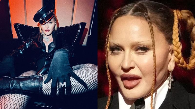 瑪丹娜驚傳加護病房治療中！演唱會緊急取消　經紀人證實揭病況