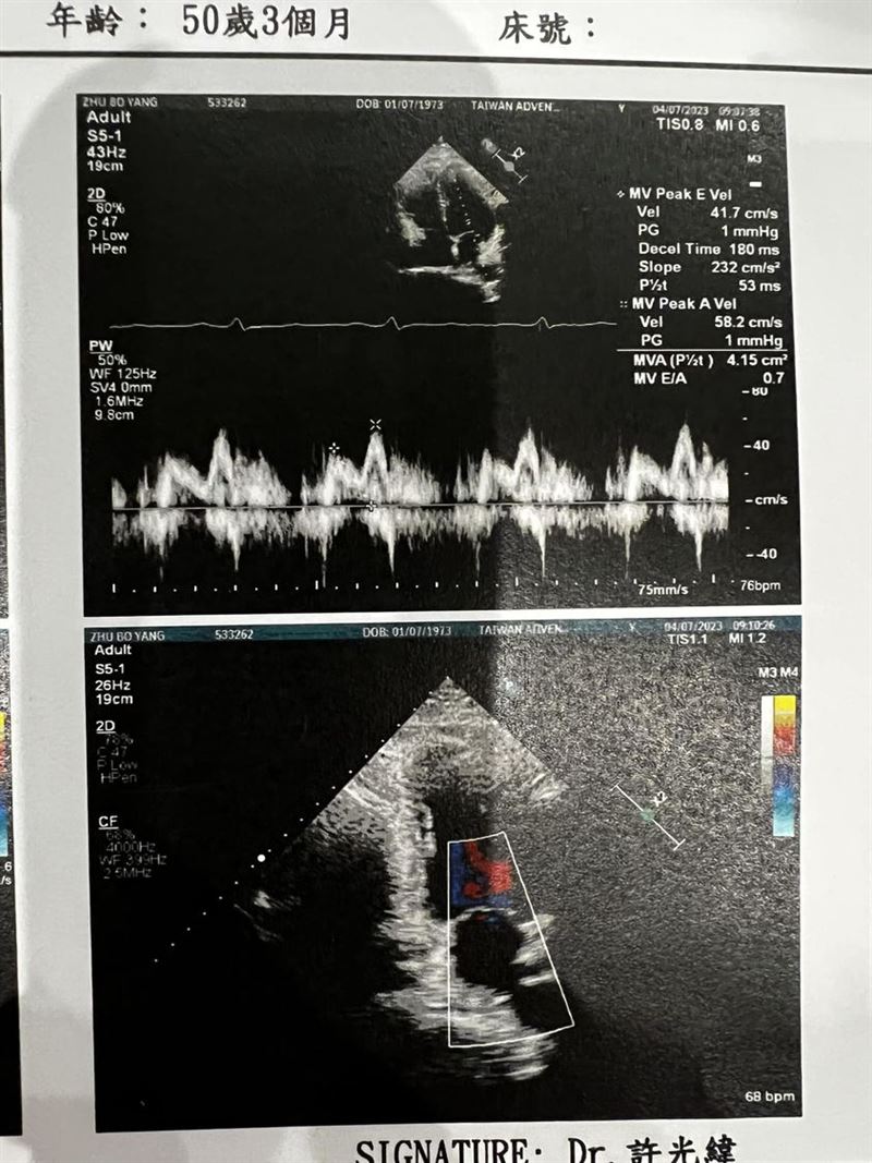 他上節目被提醒檢查…竟長4.6公分主動脈瘤「先天少1片瓣膜」跟劉真同病