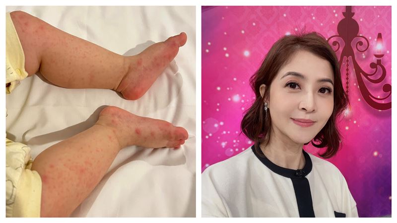 李亮瑾9月嬰突發高燒不降！驚患「兒童大魔王病」心疼喊：大寶也發燒了