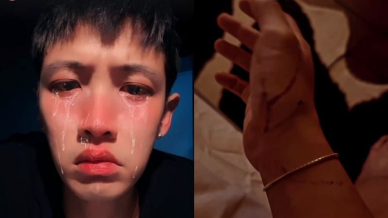 柯震東驚爆遭襲擊！「頭部大噴血」手染紅驚悚畫面曝　凶手抓到了