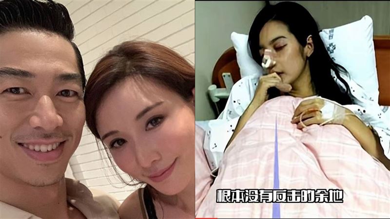林志玲再被爆遭家暴！陸網瘋傳AKIRA「打爛鼻子」住院　她首度回應了