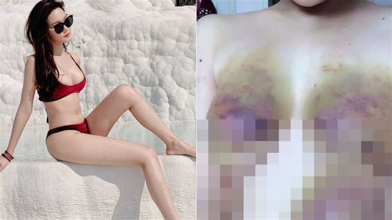百萬網紅正妹「「被騙去東南亞」」失蹤逾2個月！商會證實：確實被綁架