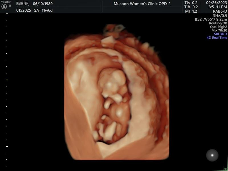 謝和弦當爸後「躁鬱不再發作」　甜曝二寶預產期：謝謝孩子治癒我