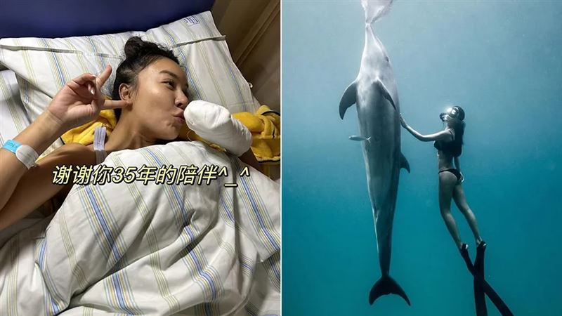 女模左手截肢！停更2個月現身…樂觀吻別：謝謝你35年的陪伴