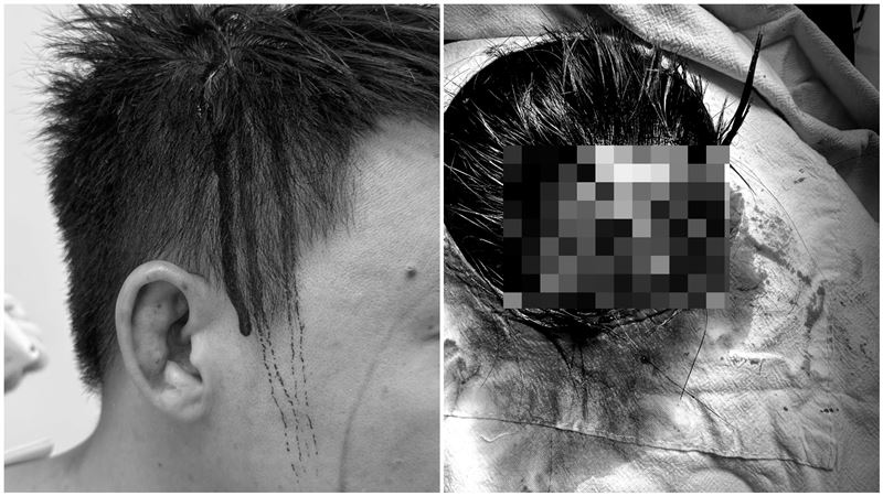 控超哥「專朝頭部攻擊」！Toyz委任律師提告4罪行　含恐嚇、殺人未遂