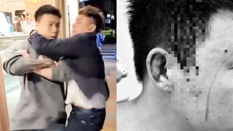 超哥嗆：「我要把你殺了！」Toyz還原被毆10分鐘過程：用硬物往頭部攻擊