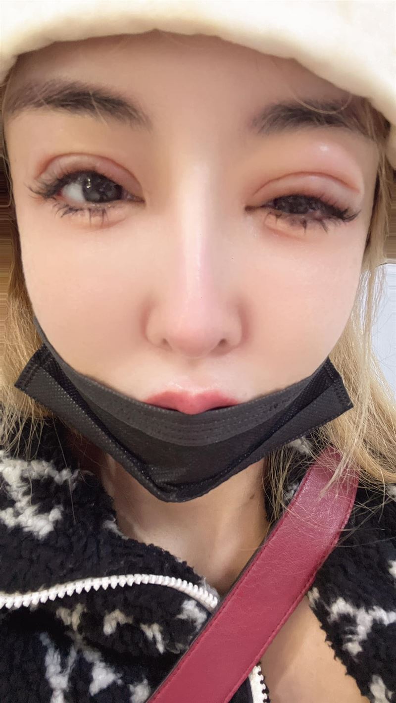 雪碧驚曝「下面被感染」　發炎停工救治！最新病況曝光