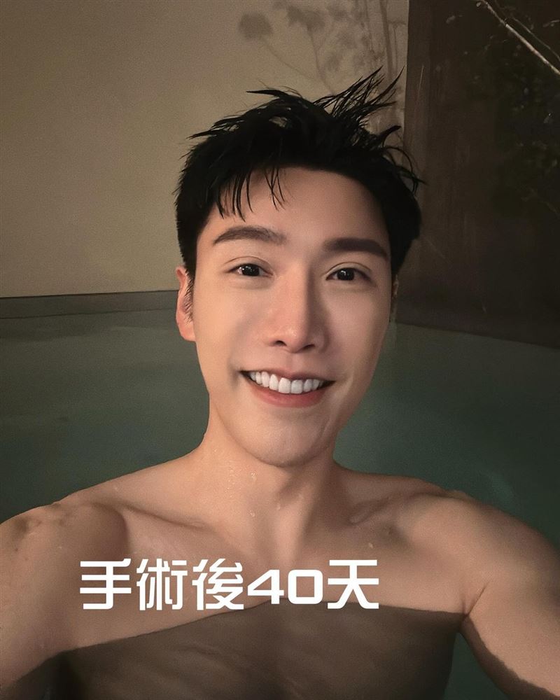 YTR小吳深夜認了「進廠維修」 ！術後51天照片曝：狀態還很不穩定