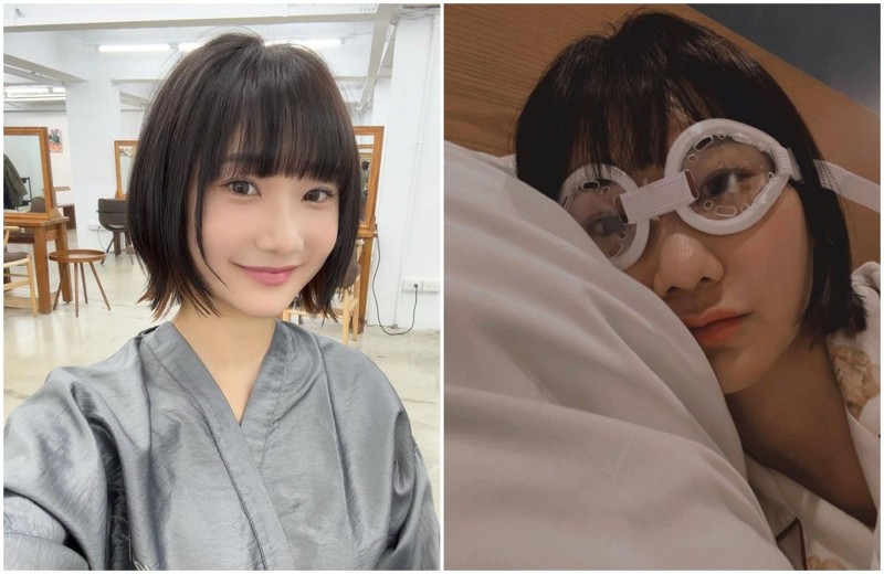 愛莉莎莎爆奔韓國找名醫動手術！公布術後「驚人成果」：好到超乎想像