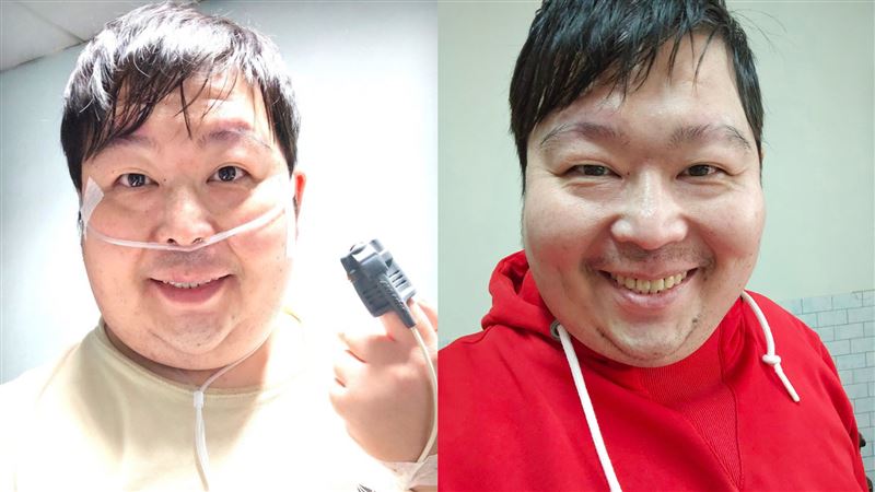 山豬最後錄影畫面曝光!認了紅斑性狼瘡「不會好」…不到1個月就過世