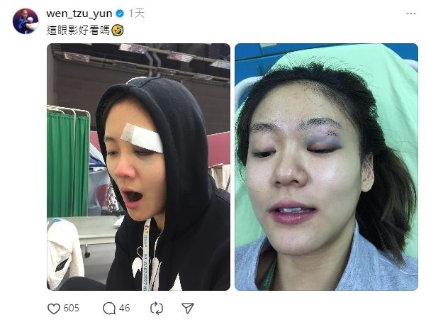 空手道女神突PO瘀青照「眼影好看嗎」　網暴動復出？文姿云回這句