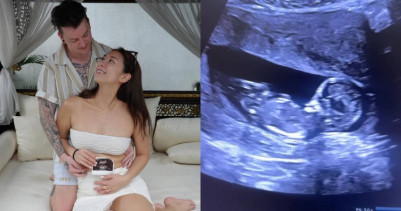 《黑澀會》米奇合體男友拍照甜曬孕肚 吐露心聲:遇到讓我想生的伴侶