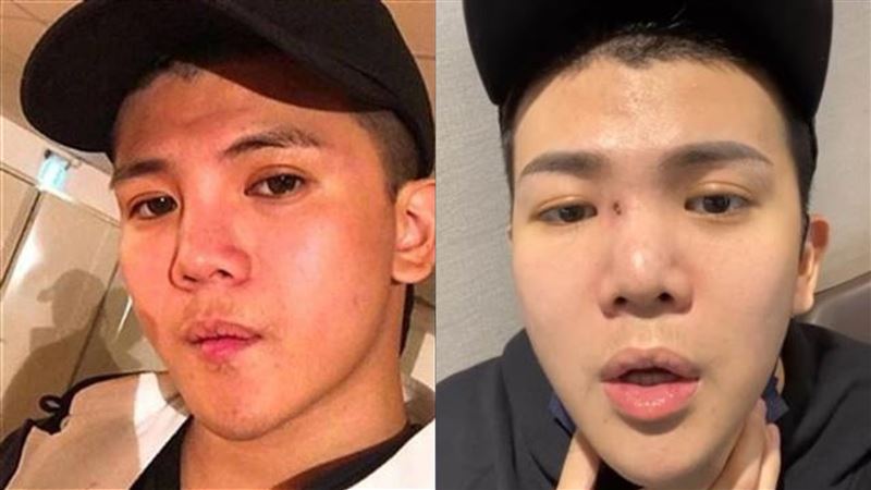 被爆上酒店！孫生曝嚴重生病「休克送醫院」　痛訴：以為我喝酒開心嗎？