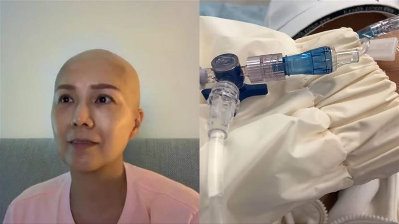 昔因白血球驟降停止化療 50歲癌末女星病況再出現「1重大變化」