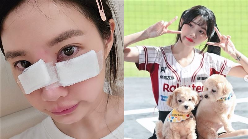 樂天女神深夜傳意外！遭愛犬咬傷「滿臉鮮血」急送醫　傷勢曝光