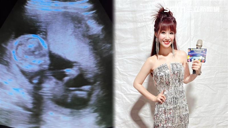 獨家／知名DJ爆懷孕！「生父翻垃圾」才知當爸…停工少賺金額曝光