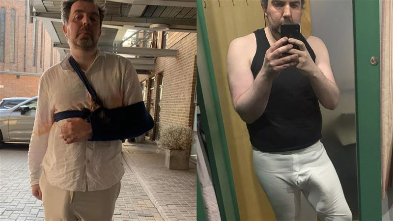 擁37公分「世界最長命根子！」男洗澡看不到腳　滑倒摔斷手臂骨折