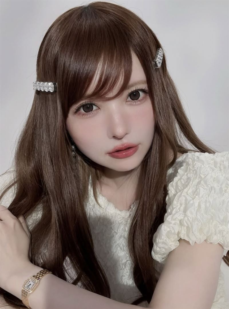 才被疑整容失敗！大咖辣模砸錢「全溶玻尿酸」　網酸爆：臉差很大