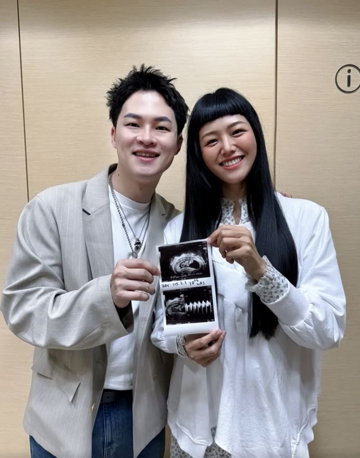 婚禮前突眼歪嘴斜！39歲男星罹顏面神經麻痺　「急送醫搶命」病況曝