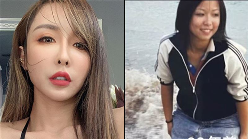 砸700萬動刀！雪碧「20多年前0整形舊照」曝　網嚇壞：也差太多了吧