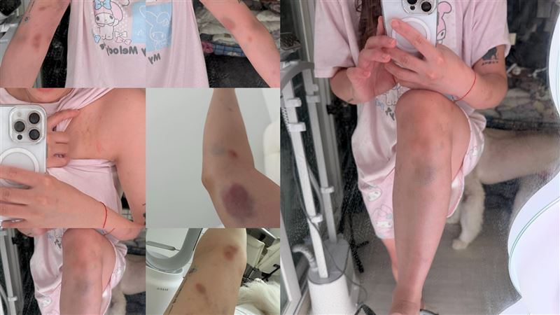 台灣網美嗆韓國男生「下體那麼小！」慘遭連打2巴掌　恐怖傷勢曝