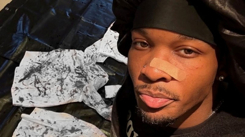 特斯拉後車廂藏肢解遺體！20歲爆紅男星遭疑腐屍案兇手　不忍發聲了