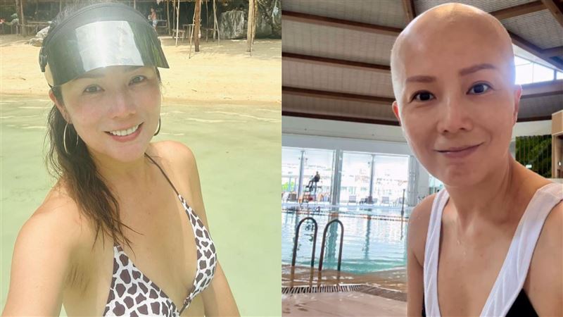 乳癌惡化擴散淋巴！51歲女星苦撐「第8次化療」續命　最新病況曝光
