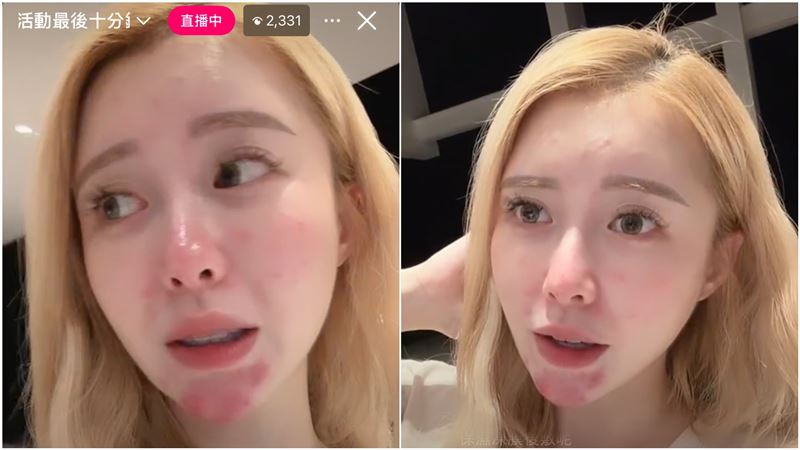 饅頭媽震撼認懷四寶117天!公開爛臉真實面貌 被問「孩子的爸」回應了