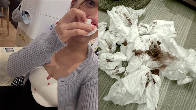 玉兔臨盆前噴血照流出! 崩潰喊:欺負孕婦很母湯「很怕一屍兩命」