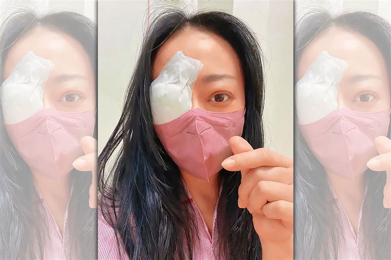 奮力抗病魔/甲狀腺引發罕見單眼斜視! 高慧君連動3次手術恐失明