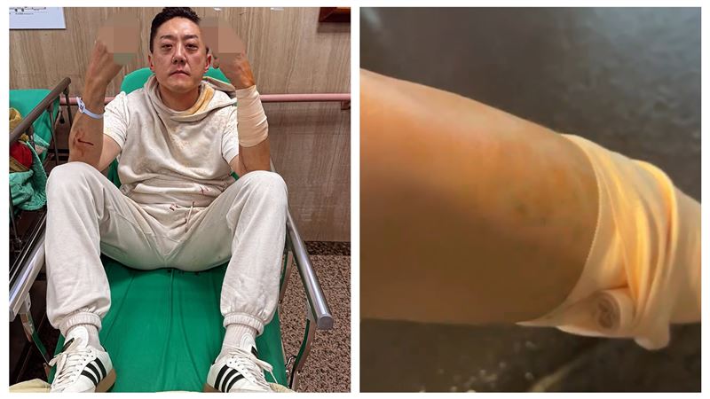 埋伏砍殺夜店大亨夏天倫　北市警逮1名男子　行兇動機釐清中