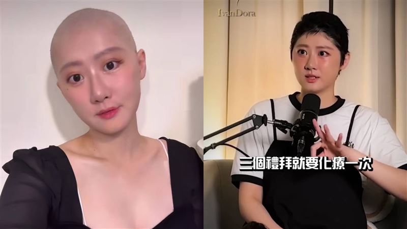罹癌收入少5倍!本土女星剃髮化療「煎熬過程」曝:不是從前的自己