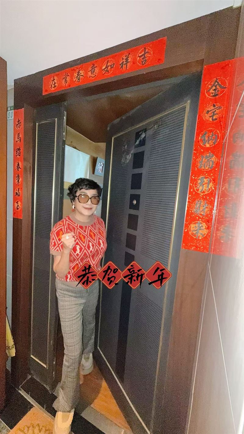 出國前打醫美　謝麗金腫到「人臉辨識失敗」卡海關