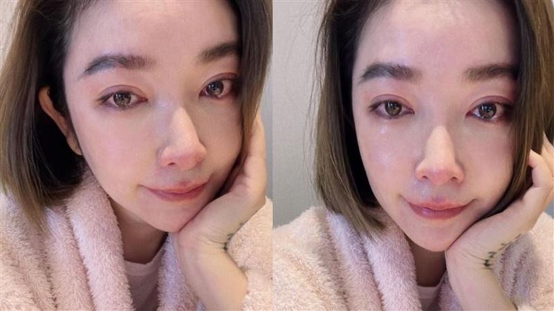 許維恩罹乳癌急切雙乳救命！　首度發聲：「感恩11小時後的我還能呼吸」