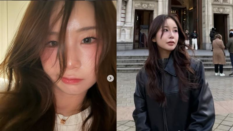 在台韓籍網紅章魚國道遭疲勞駕駛撞擊！醫檢查驚覺「腰斷過」傷勢曝光