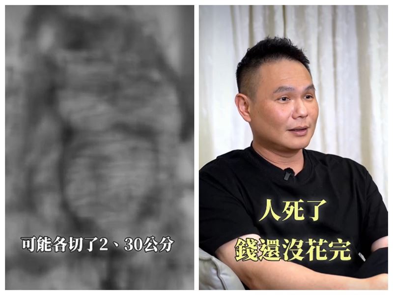 超哥罹癌0期切腸續命 憂人死了錢還沒花完!難忍愛妻蘇菲守活寡