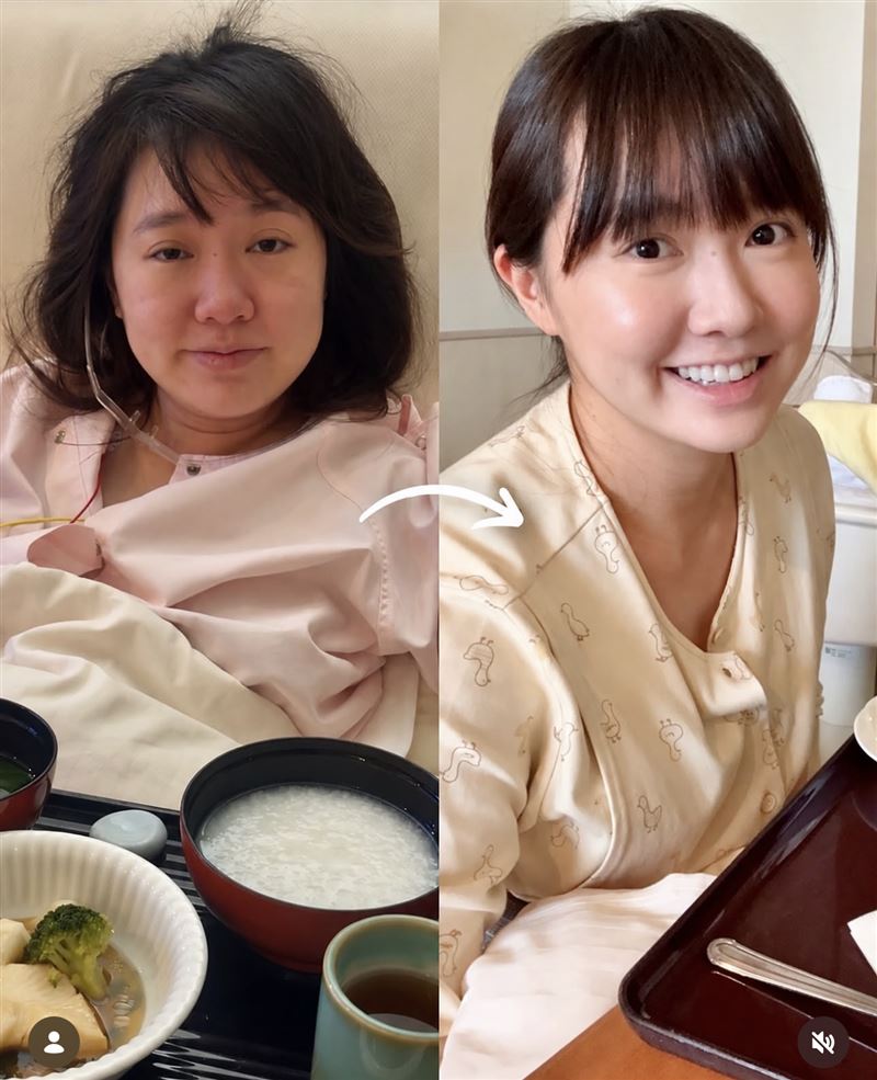成台灣媳婦一年多!Mana返日剖腹產女 產後對比照曝:變化這麼大
