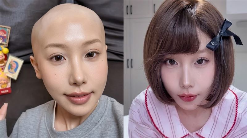 25歲網紅胃癌病逝！生前淚揭「奪命壞習慣」竟成遺言　網一看全嚇傻